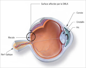 Schéma de l'œil DMLA